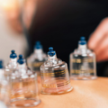 Cupping Therapy - Massage Add On