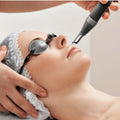 Laser Pigment Removal