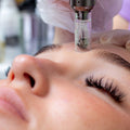 PRP Microneedling